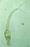 Schistosoma cercaria